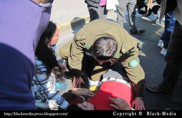 Compleja situación de salud vive estudiante secundario atropellado en la marcha del jueves pasado