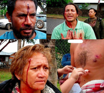 Rechazo de los isleños a la violencia en Rapa Nui