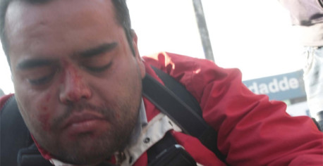 Fotógrafo denuncia hostigamiento y agresiones de Carabineros por no entregar imágenes de protesta