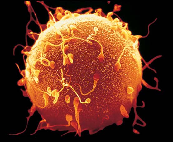 Células madre podrían recuperar la fertilidad de la esperma