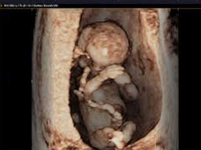 Moderno ecotomógrafo captura impresionantes imágenes del vientre materno en Hospital Gustavo Fricke