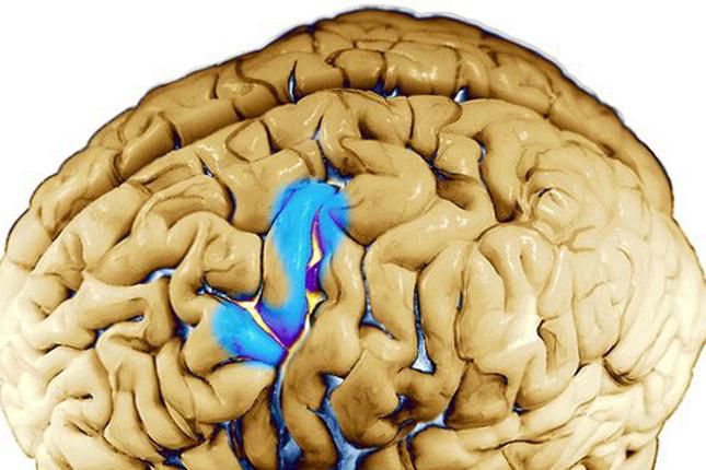 Estos neurólogos pueden leer tu mente