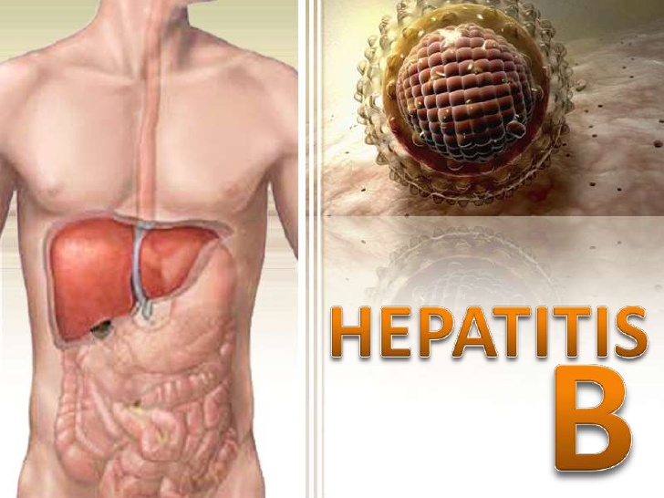 Magallanes lidera tasa de hepatitis B y triplica promedio nacional en 2013