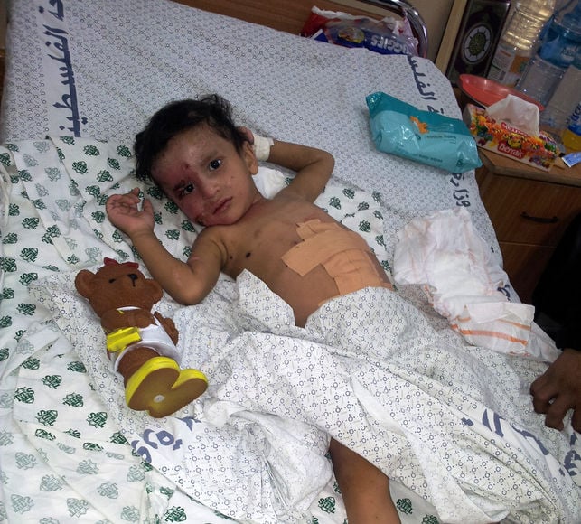 Niños heridos en Gaza necesitan traslado urgente para sobrevivir