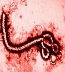 Argentina desarrolla un método para diagnosticar el ébola en 24 horas
