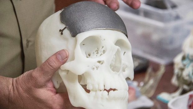 ¿Cómo impactarán las impresoras 3D en la medicina?
