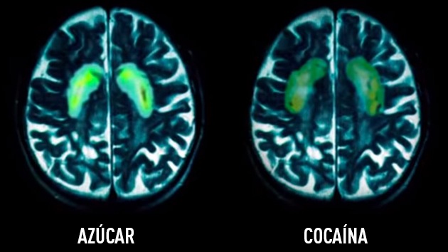 ¿Qué hace el azúcar con nuestro cerebro?