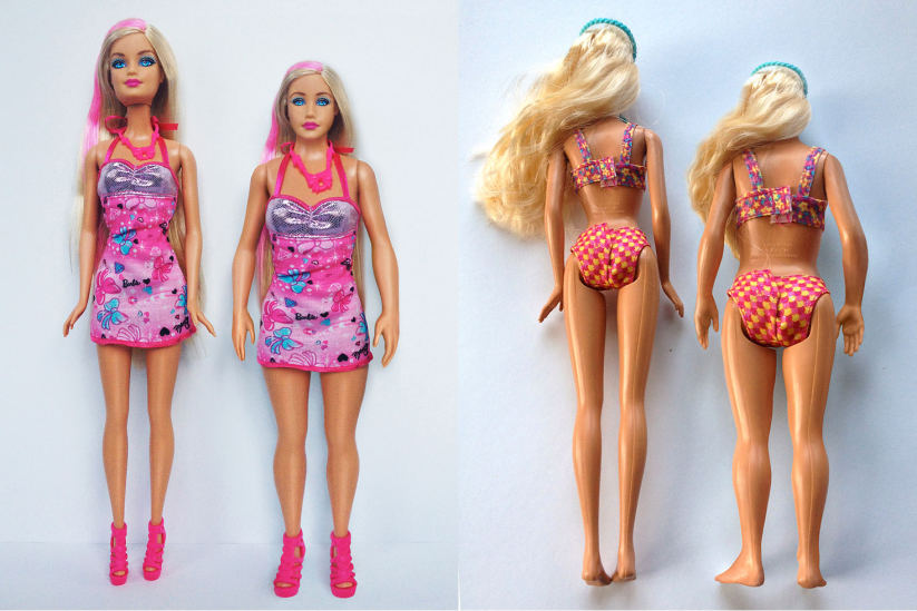 La nueva muñeca Barbie viene con moretones, espinillas y un cuerpo realista