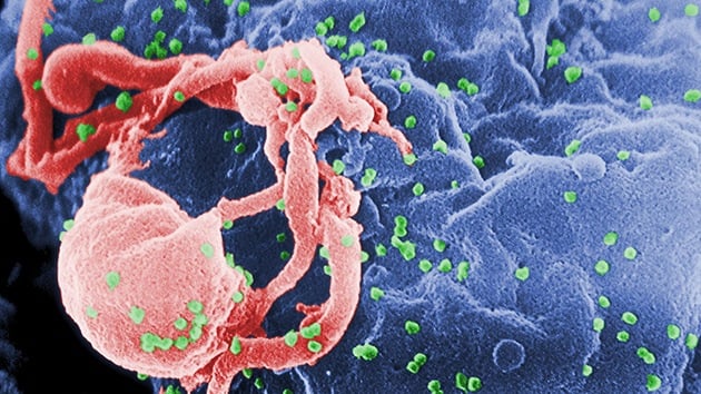 Logro esperanzador : Dos personas logran curarse espontáneamente del VIH
