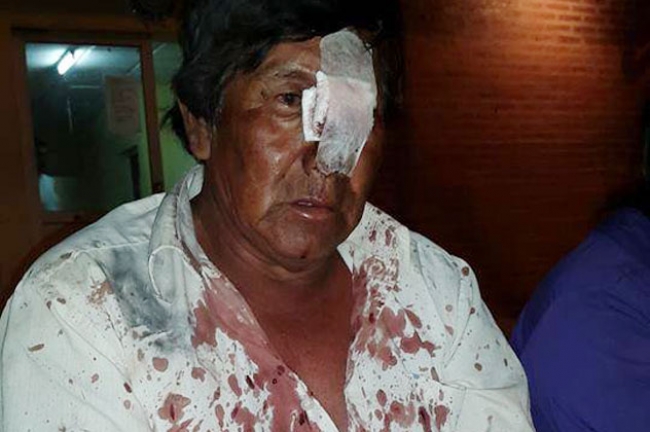 Piden investigar una violenta represión contra indígenas en Argentina