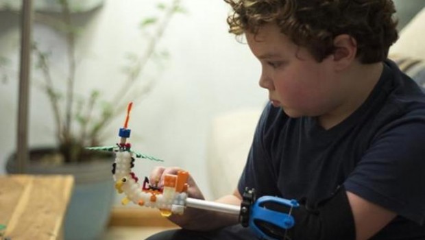 Niño de 9 años construye su propia prótesis de brazo con Legos