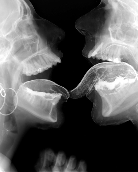 Pornografía científica: actos sexuales captados en radiografías