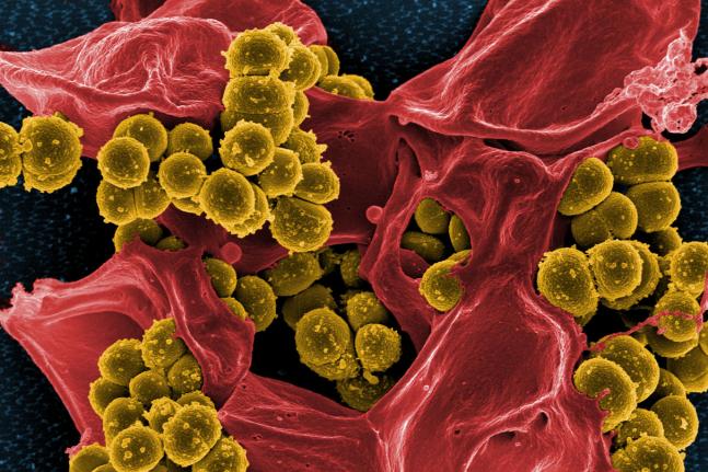Las ‘súperbacterias’ podrían matar a más personas que el cáncer en 2050