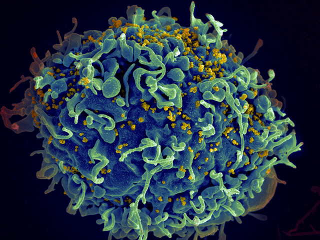 Nuevo agente poderoso anti-VIH podría funcionar en vacuna contra la enfermedad