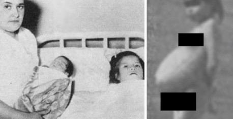 La historia real de Lina Medina: La niña que fue madre a los 5 años ¡Impactante!