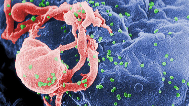Investigadores: «El VIH se propaga como un gusano informático»