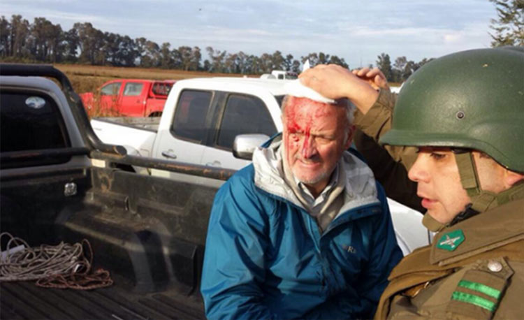 Ex militante de Patria y Libertad recibe chuecazo por bloquear ocupación de tierras mapuche