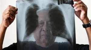 Asbesto en Coronel: “el gobierno va a ser recordado por esta matanza”