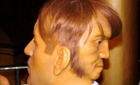 La inquietante historia de Edward Mordrake, el hombre con dos caras