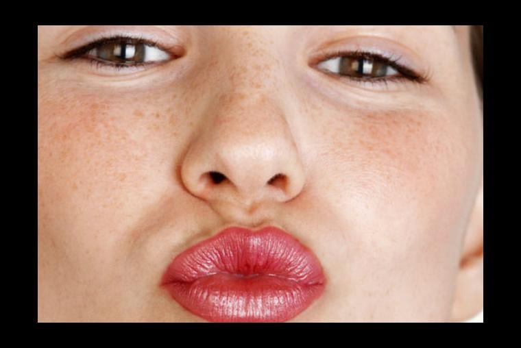 10 enfermedades que puedes adquirir con un beso