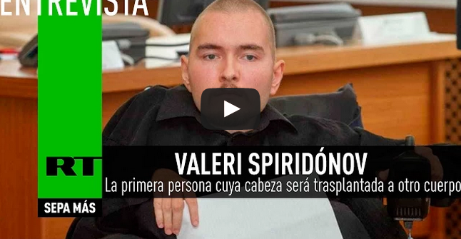 Entrevista a Valeri Spiridónov, la primera persona en el mundo cuya cabeza será trasplantada a otro cuerpo: «Llegaré hasta el final»