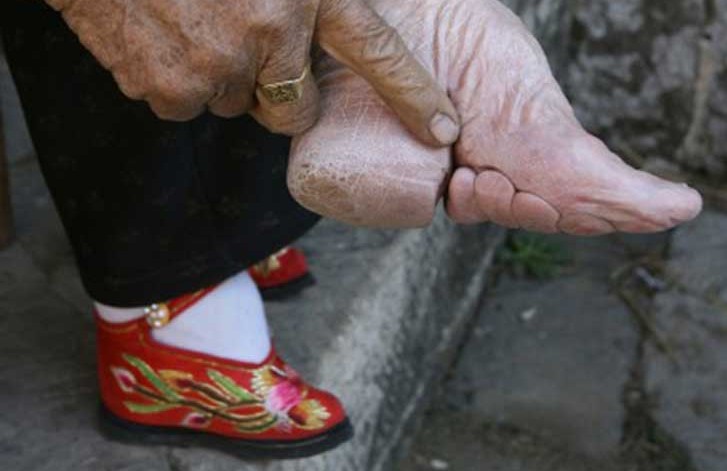 El doloroso estereotipo de belleza que deformó los pies de miles de mujeres en China
