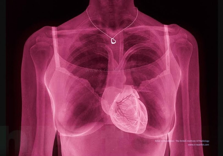 30 Fotos de rayos X que te cambiarán la manera de ver el cuerpo humano
