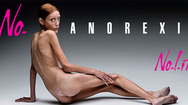 Los 10 casos documentados más impactantes de personas con anorexia