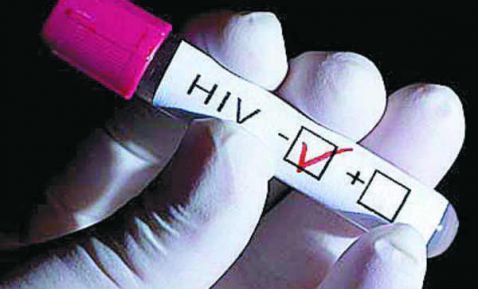 Joven francesa con VIH logra remisión sin medicamentos