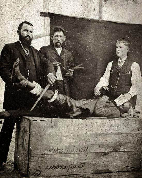35 Fotos que muestran cómo era la medicina antigua 35 Fotos que muestran cómo era la medicina antigua