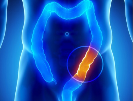Más del 90% de las enfermedades están relacionadas con un colon sucio. ¡Aprende a limpiarlo!