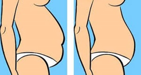 ¿Qué tipo de barriga tienes y cómo reducirla?
