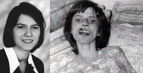 Anneliese Michel: La terrible historia de un exorcismo