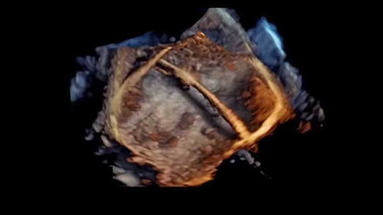 Video: Un nuevo programa permite obtener imágenes en 4D del corazón humano