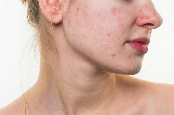 Desquilibrio hormonal por estres perdida de peso edad Desquilibrio hormonal por estres perdida de peso edad