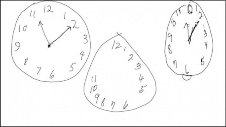 El test del reloj que permite detectar el alzhéimer y el párkinson