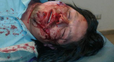 VIDEO: Comunero mapuche resulta gravemente herido tras allanamiento policial a comunidad Coñomil Epuleo