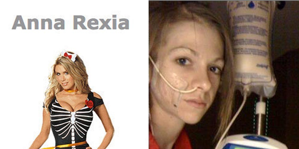 Anna Rexia: el disfraz de anorexia que está causando indignación en las redes sociales