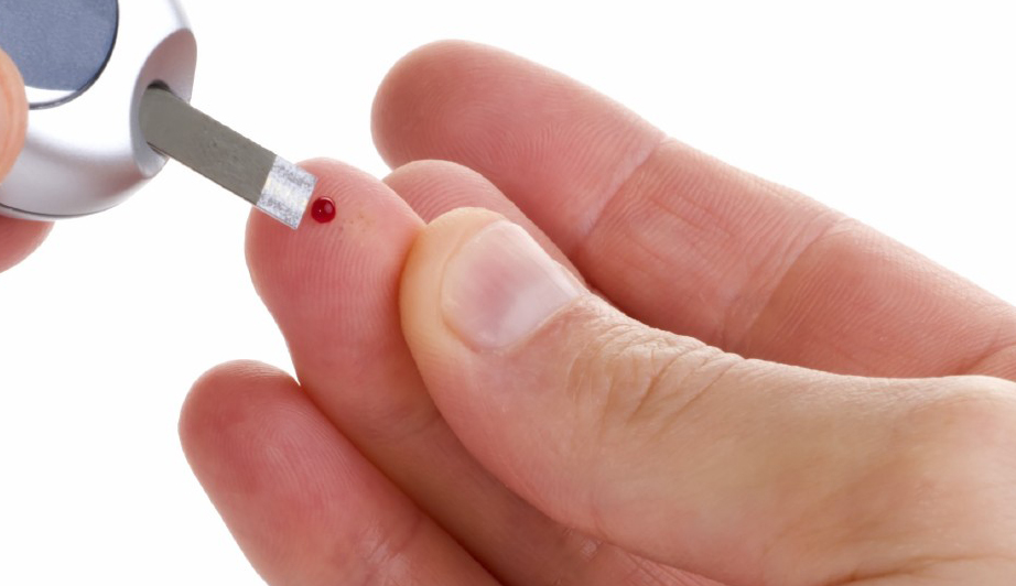 ¿Cómo saber si estás padeciendo prediabetes?