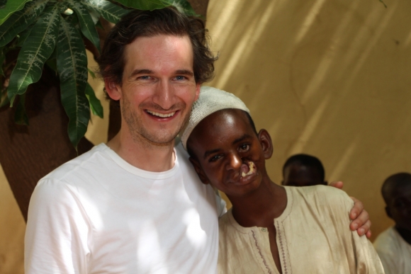 Transformando los rostros y las vidas de pacientes que sufren de noma en Nigeria
