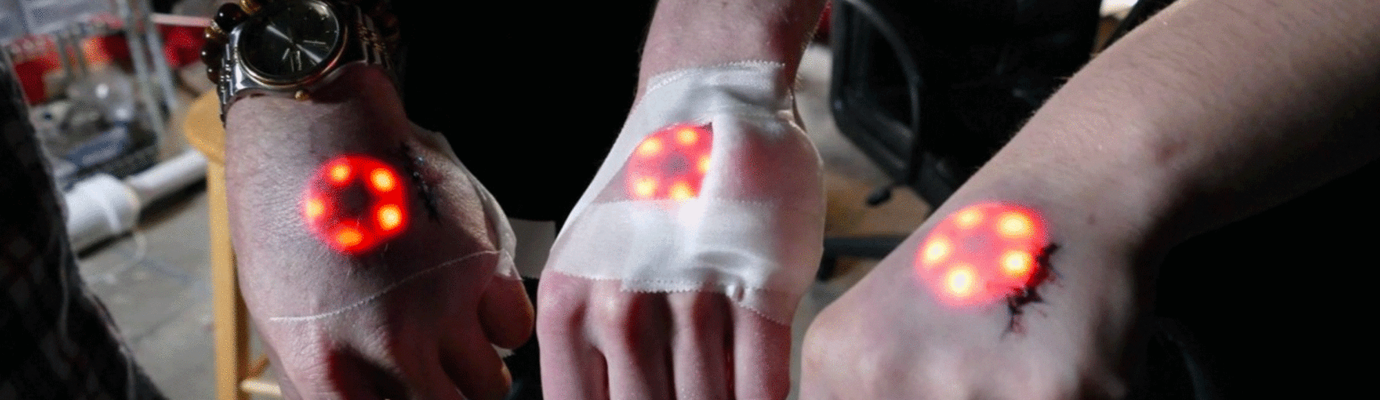 Estos biohackers se implantaron luces LED en el brazo