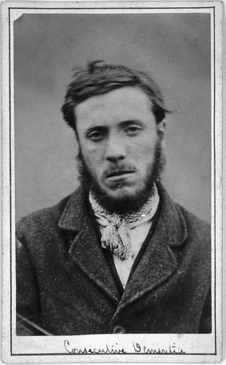 Fotografías de internos psiquiátricos del siglo XIX