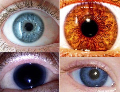 Los colores de ojos más raros en seres humanos ¡Impresionante!