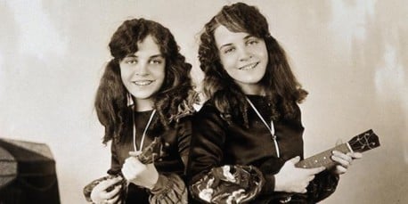 Conoce la triste historia de las hermanas siamesas “encadenadas” por la espalda