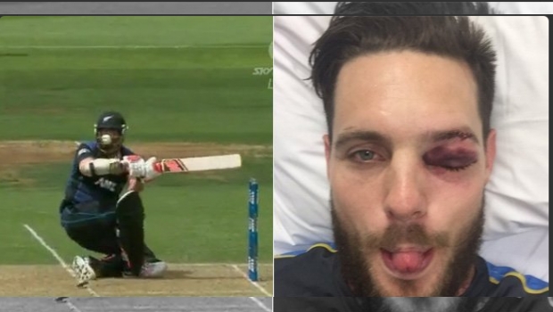 VIDEO: Jugador recibe feroz golpe en un juego de Críquet