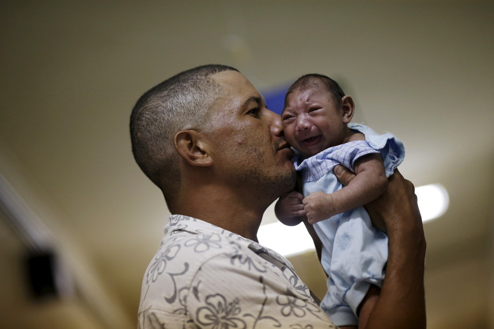 Estas imágenes muestran las TERRIBLES consecuencias del virus zika ¡Desgarrador!