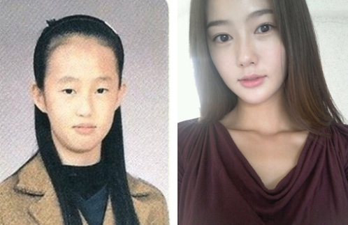15 Coreanos antes y después de sus cirugías plásticas. ¡El resultado es impresionante!