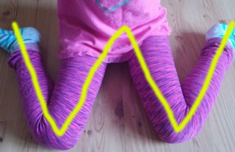 Sentarse en ‘W’, una peligrosa postura para los NIÑOS ¡Descubre la razón!