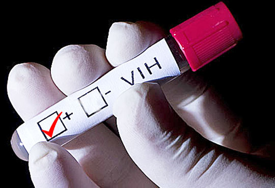 Un estudio reveló que el VIH sigue creciendo aunque no sea detectable en la sangre