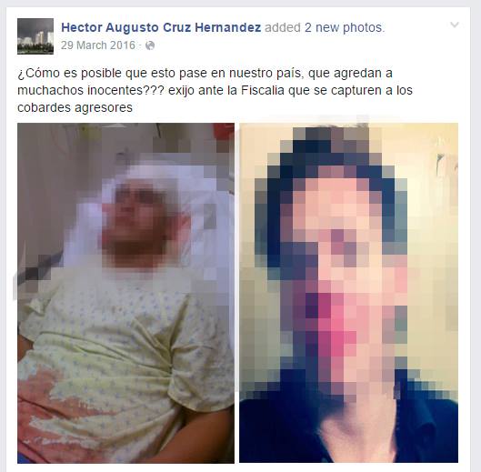 Circula una supuesta Imagen de dos integrantes de «Los Porkys» golpeados